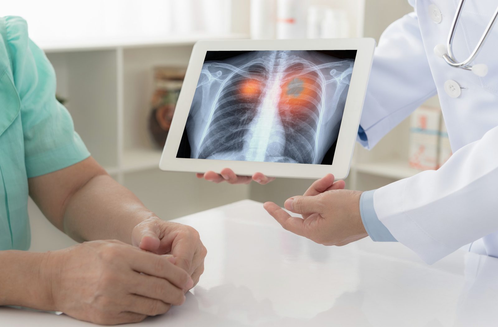 Non-small Cell Lung Cancer clinical file review
